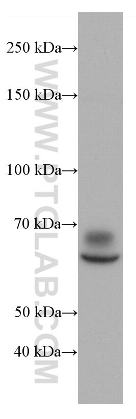 Poliovirus receptor