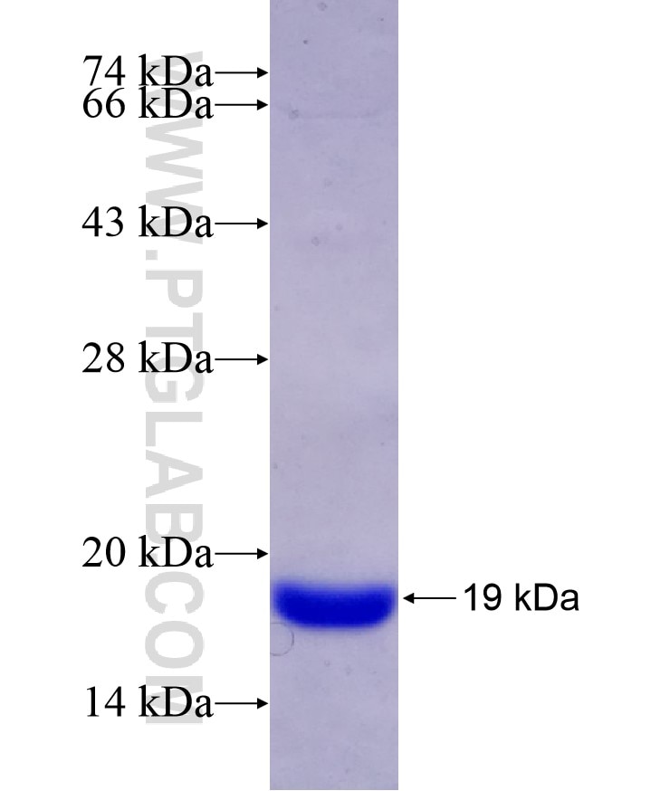 PVRIG fusion protein Ag13815 SDS-PAGE