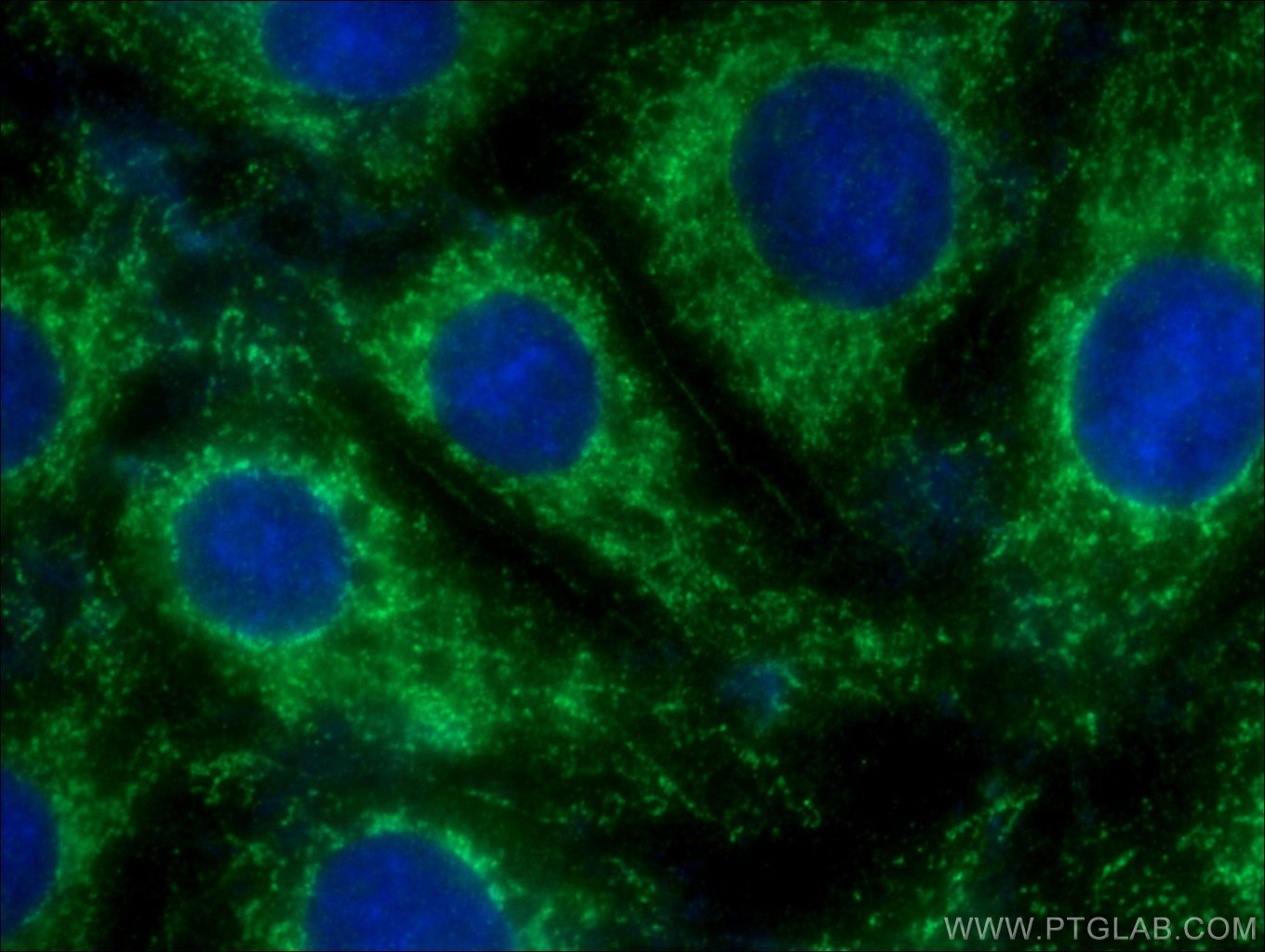 Immunofluorescence (IF) / fluorescent staining of SH-SY5Y cells using Nectin-1/PVRL1 Polyclonal antibody (24713-1-AP)