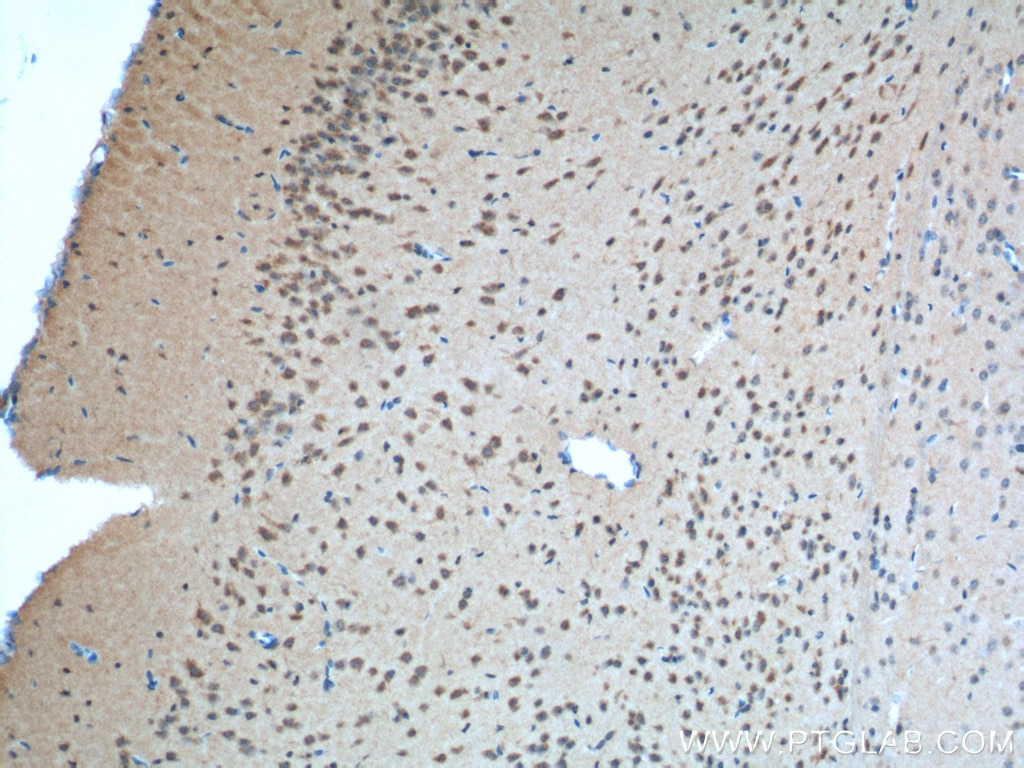 IHC staining of mouse brain using 24713-1-AP