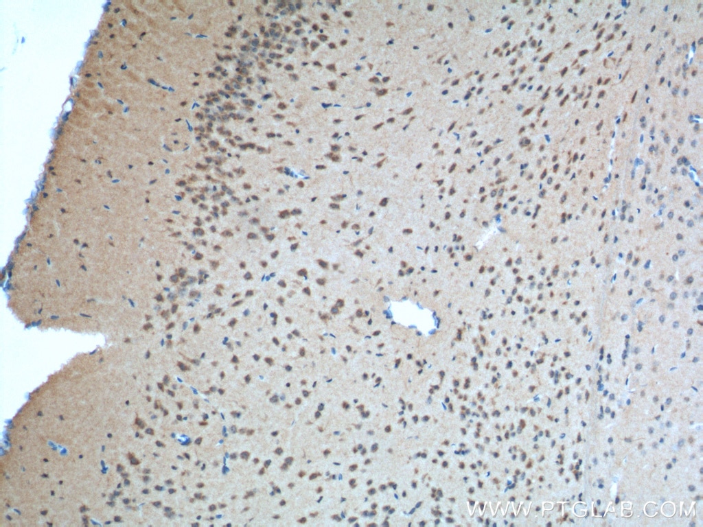 Immunohistochemistry (IHC) staining of mouse brain tissue using Nectin-1/PVRL1 Polyclonal antibody (24713-1-AP)