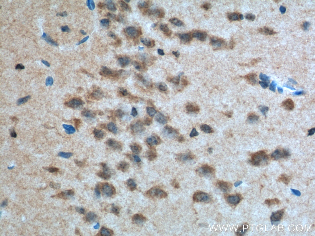 Immunohistochemistry (IHC) staining of mouse brain tissue using Nectin-1/PVRL1 Polyclonal antibody (24713-1-AP)