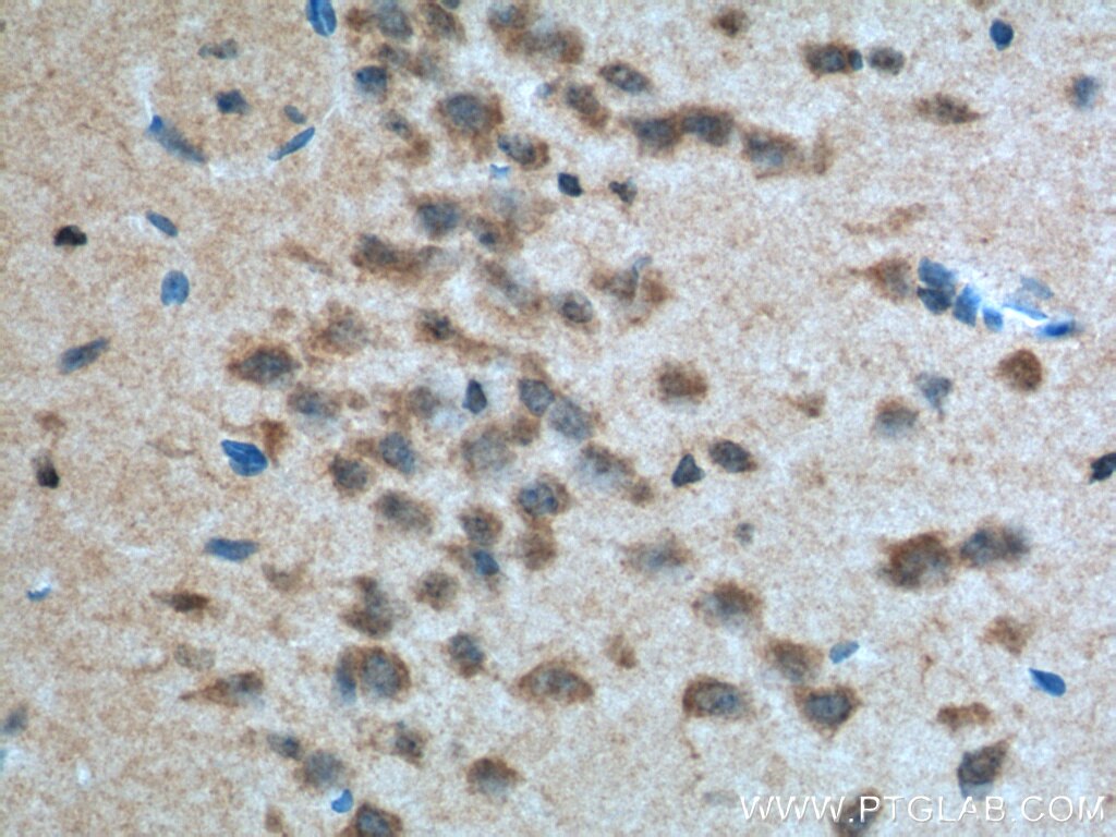 IHC staining of mouse brain using 24713-1-AP