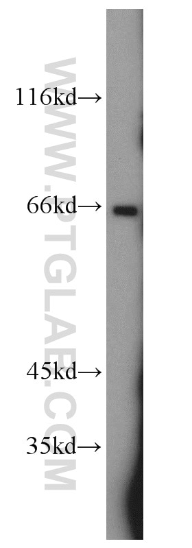 Western Blot (WB) analysis of mouse heart tissue using Nectin 2 Polyclonal antibody (10100-2-AP)