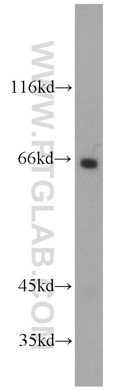 WB analysis of mouse kidney using 10100-2-AP