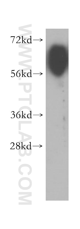 Nectin-3/PVRL3 Polyclonal antibody