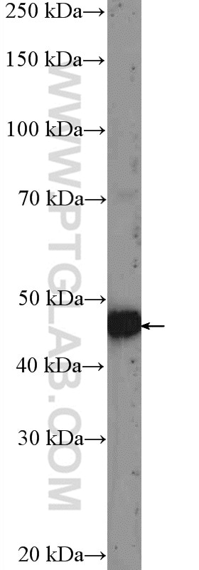 Western Blot (WB) analysis of Jurkat cells using PWP1 Polyclonal antibody (14767-1-AP)