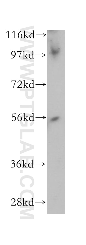 Western Blot (WB) analysis of Jurkat cells using PWP1 Polyclonal antibody (14767-1-AP)