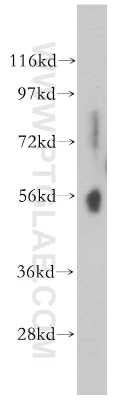 Western Blot (WB) analysis of human liver tissue using PWP1 Polyclonal antibody (14767-1-AP)