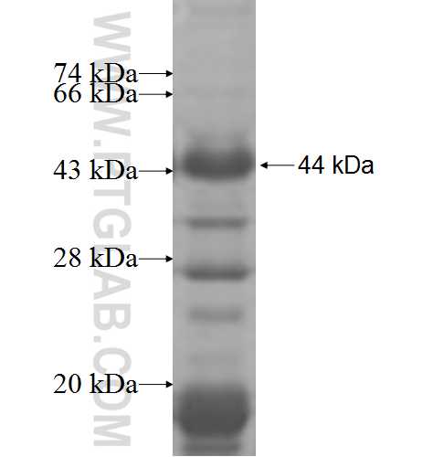 PWP1 fusion protein Ag6868 SDS-PAGE PWP1 fusion protein Ag6868 SDS-PAGE