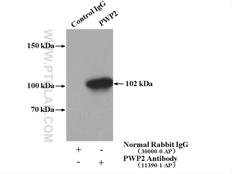 Immunoprecipitation (IP) experiment of HeLa cells using PWP2 Polyclonal antibody (11390-1-AP)