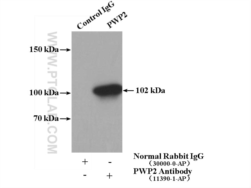 IP experiment of HeLa using 11390-1-AP