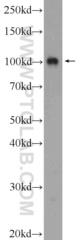 Western Blot (WB) analysis of HeLa cells using PWP2 Polyclonal antibody (11390-1-AP)