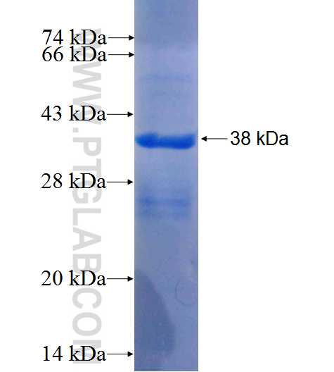 PXDN fusion protein Ag26339 SDS-PAGE