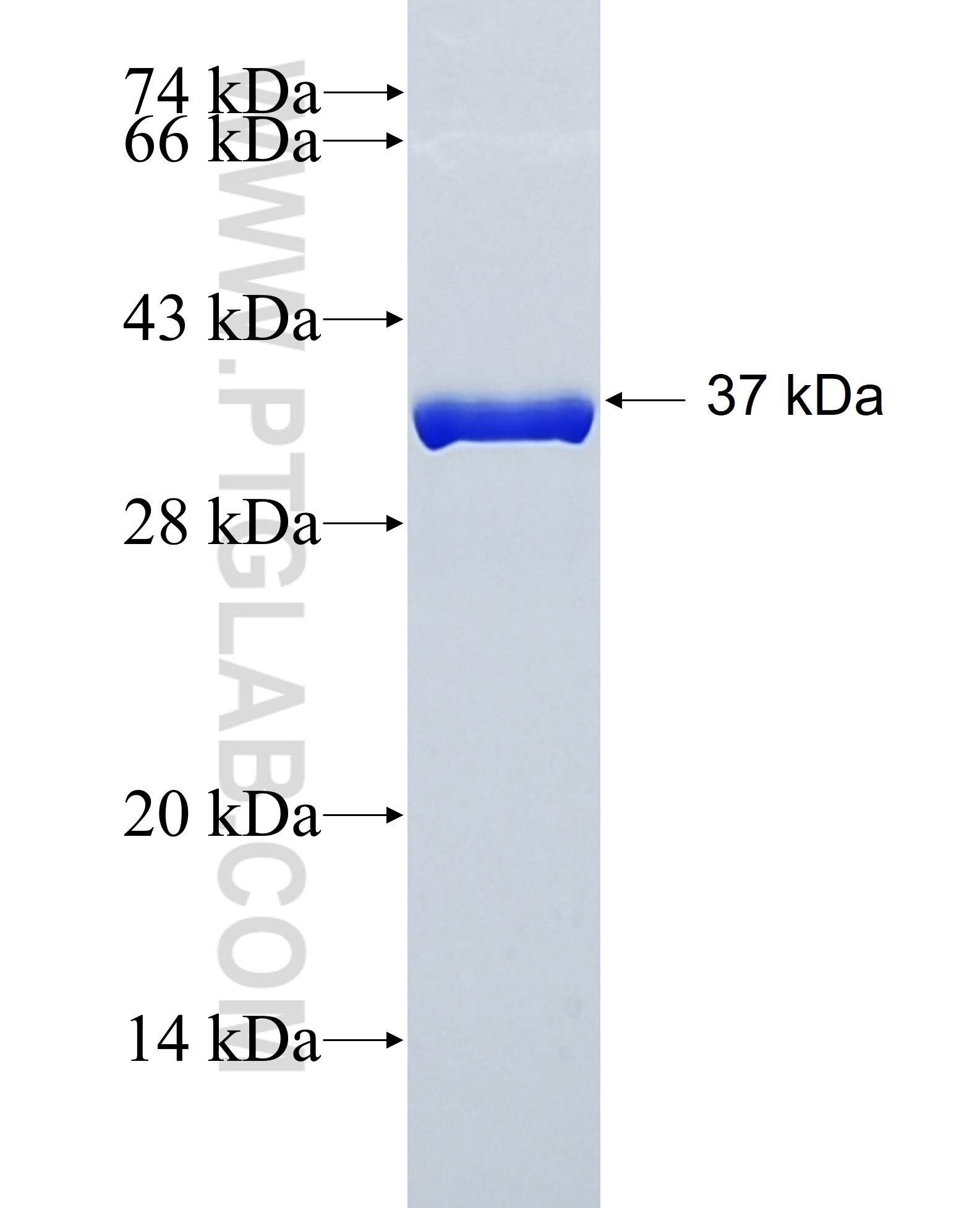 PXDN fusion protein Ag26339 SDS-PAGE