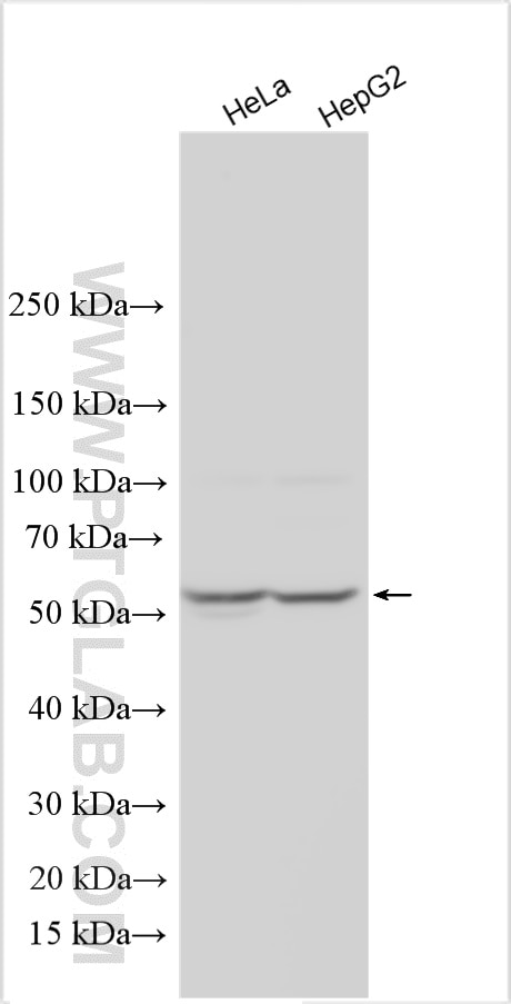 Western Blot (WB) analysis of various lysates using PXK Polyclonal antibody (16315-1-AP)