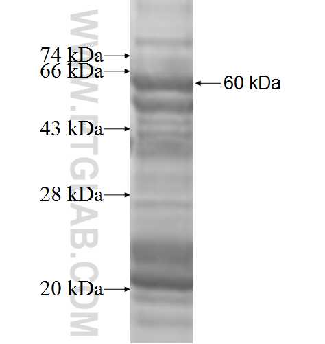 PXK fusion protein Ag9362 SDS-PAGE