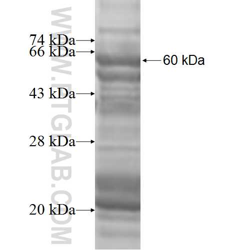 PXK fusion protein Ag9362 SDS-PAGE