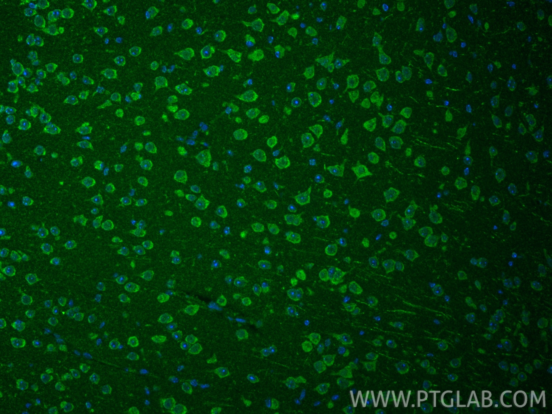 IF Staining of mouse brain using 24801-1-AP Immunofluorescence (IF) / fluorescent staining of mouse brain tissue using PXMP2 Polyclonal antibody (24801-1-AP)