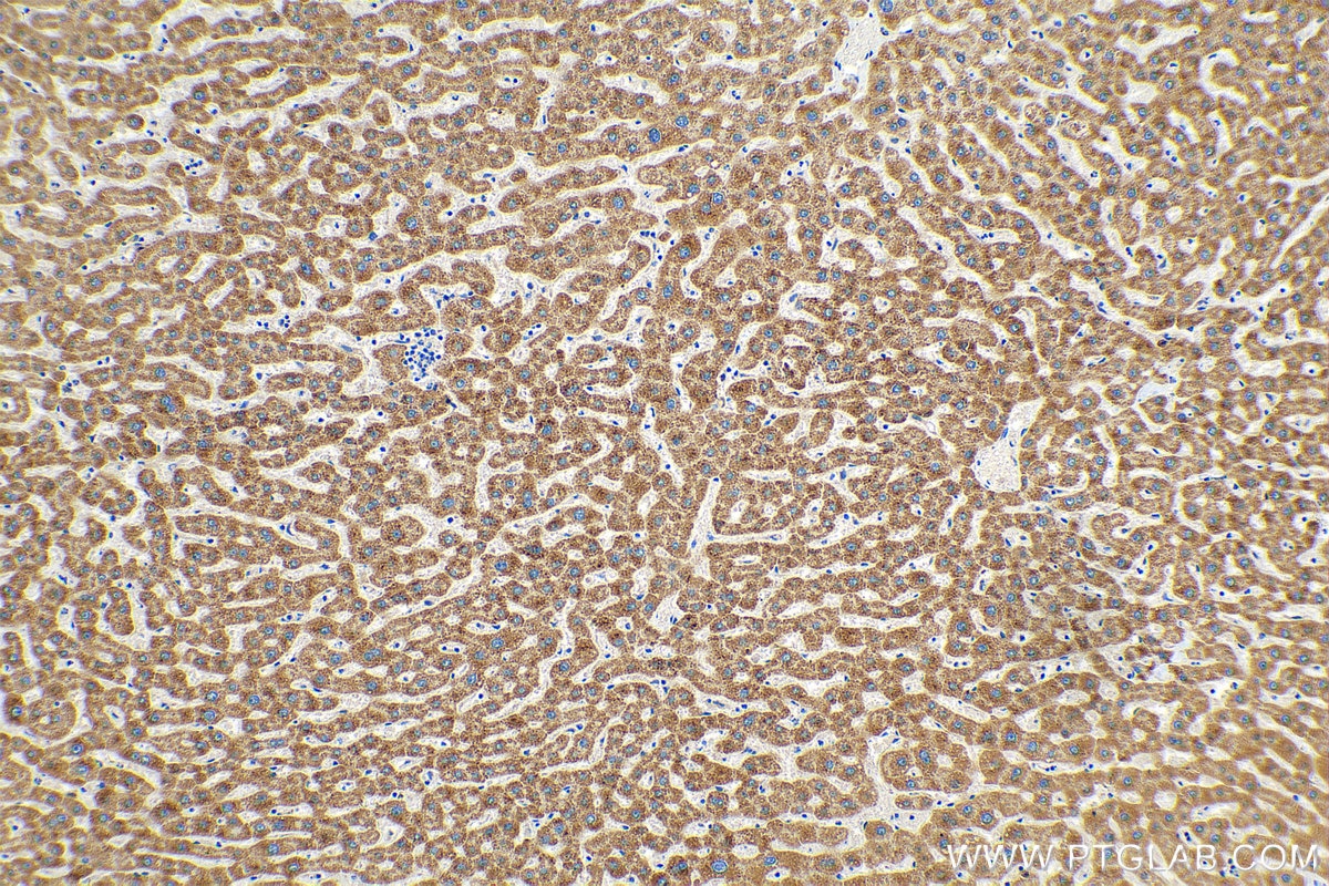 Immunohistochemistry (IHC) staining of human liver tissue using PXMP2 Polyclonal antibody (24801-1-AP)