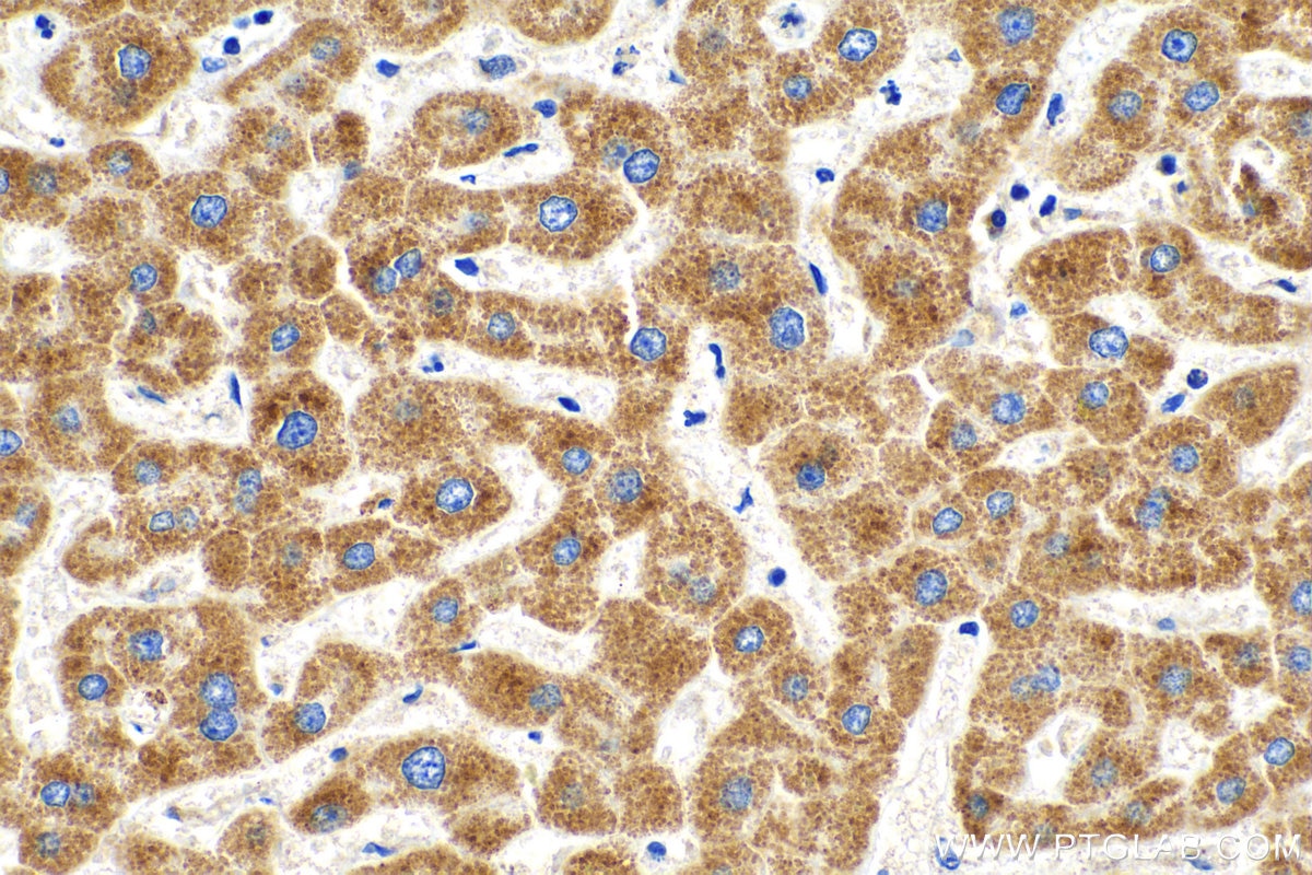 Immunohistochemistry (IHC) staining of human liver tissue using PXMP2 Polyclonal antibody (24801-1-AP)