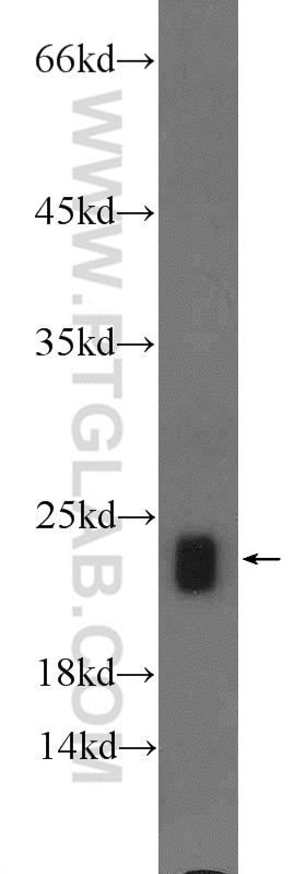 Western Blot (WB) analysis of rat liver tissue using PXMP2 Polyclonal antibody (24801-1-AP)