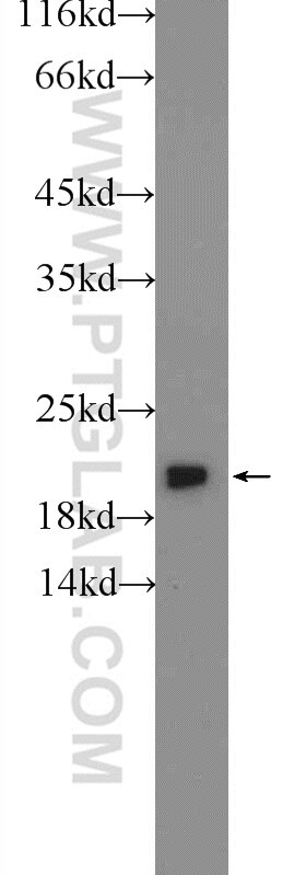 Western Blot (WB) analysis of mouse liver tissue using PXMP2 Polyclonal antibody (24801-1-AP)