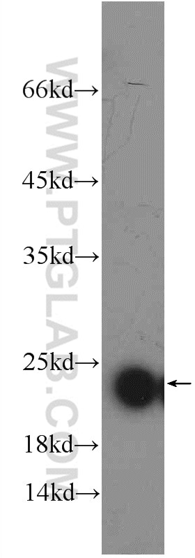 Western Blot (WB) analysis of rat liver tissue using PXMP2 Polyclonal antibody (24801-1-AP)