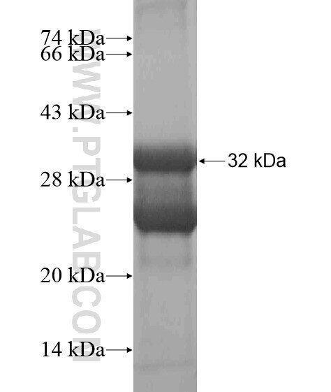 PXMP2 fusion protein Ag20590 SDS-PAGE