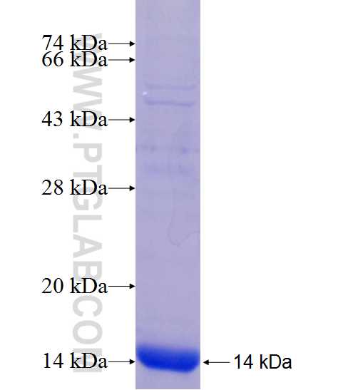 PXMP2 fusion protein Ag20684 SDS-PAGE