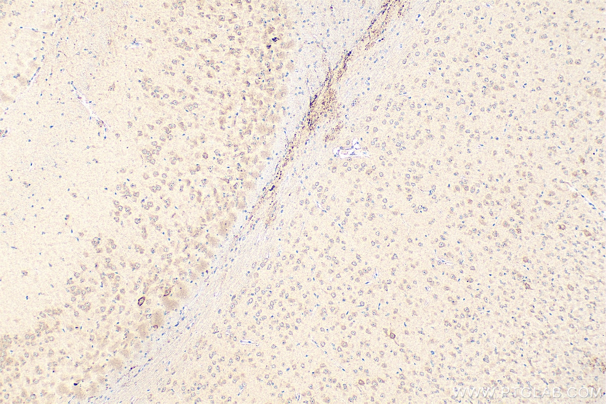 Immunohistochemistry (IHC) staining of mouse brain tissue using PXMP3 Polyclonal antibody (22163-1-AP)