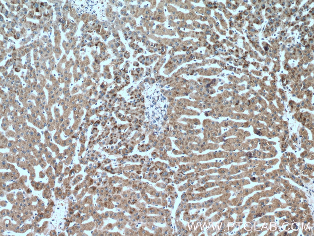 Immunohistochemistry (IHC) staining of human liver tissue using PXMP3 Polyclonal antibody (22163-1-AP)