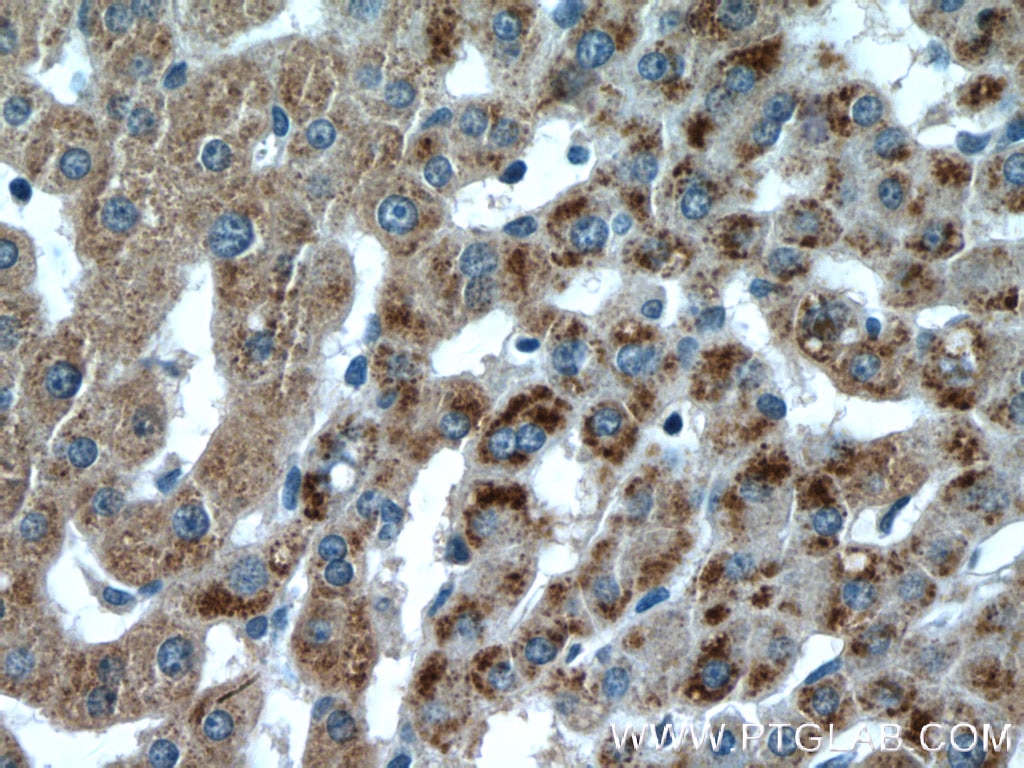 Immunohistochemistry (IHC) staining of human liver tissue using PXMP3 Polyclonal antibody (22163-1-AP)