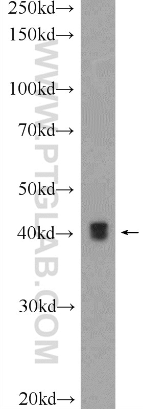 Western Blot (WB) analysis of HeLa cells using PXMP3 Polyclonal antibody (22163-1-AP)