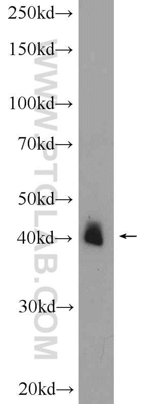 Western Blot (WB) analysis of mouse brain tissue using PXMP3 Polyclonal antibody (22163-1-AP)