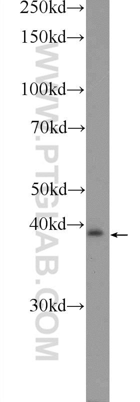 Western Blot (WB) analysis of mouse liver tissue using PXMP3 Polyclonal antibody (22163-1-AP)