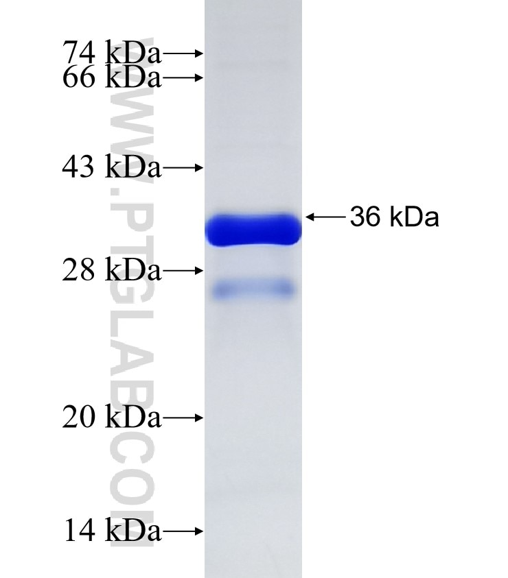 PXMP3 fusion protein Ag17815 SDS-PAGE