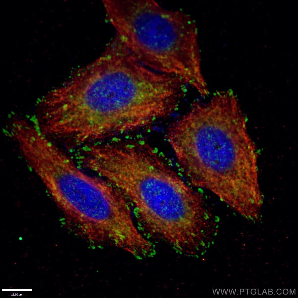 Immunofluorescence (IF) / fluorescent staining of HepG2 cells using Paxillin Polyclonal antibody (10029-1-Ig)