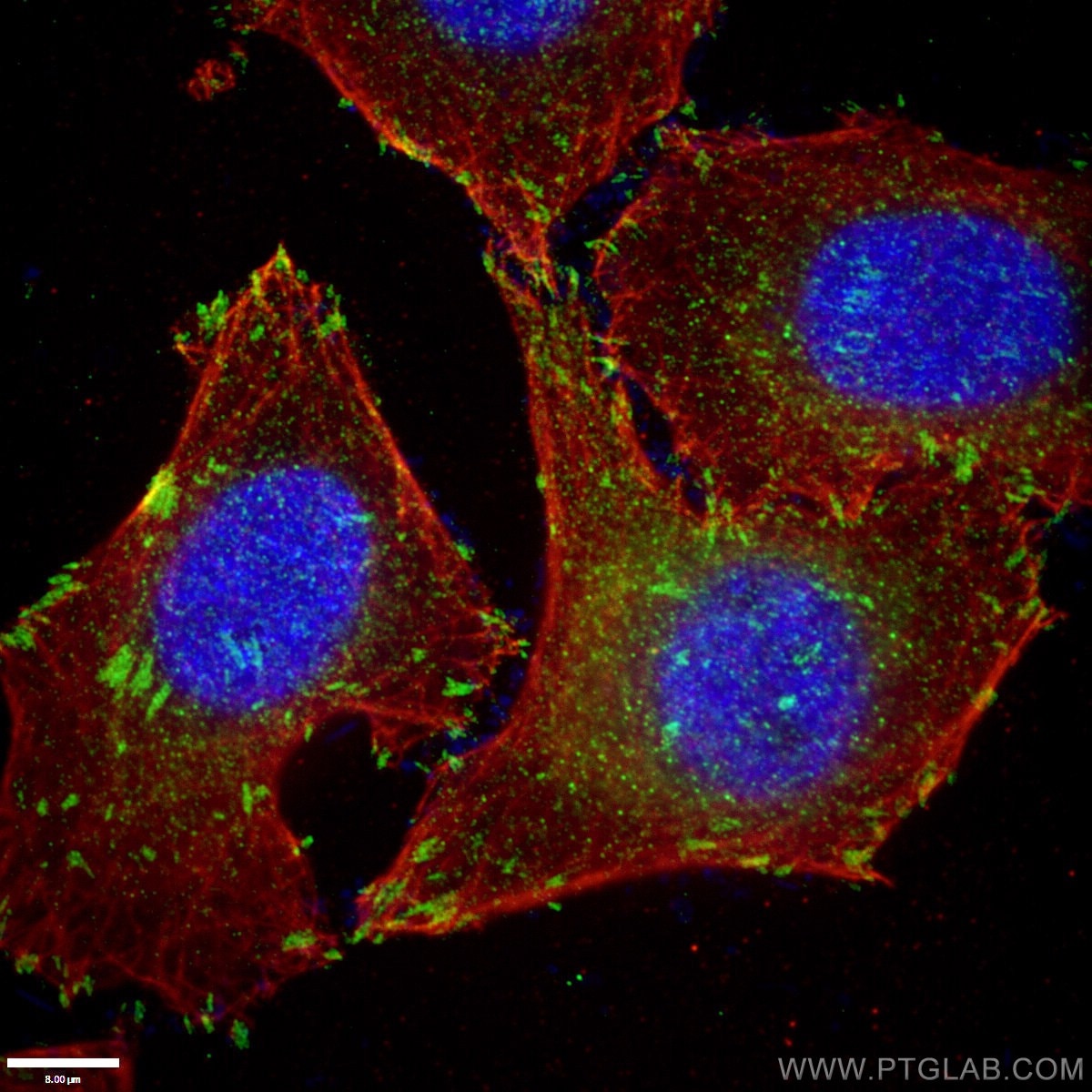 Immunofluorescence (IF) / fluorescent staining of HepG2 cells using Paxillin Polyclonal antibody (10029-1-Ig)