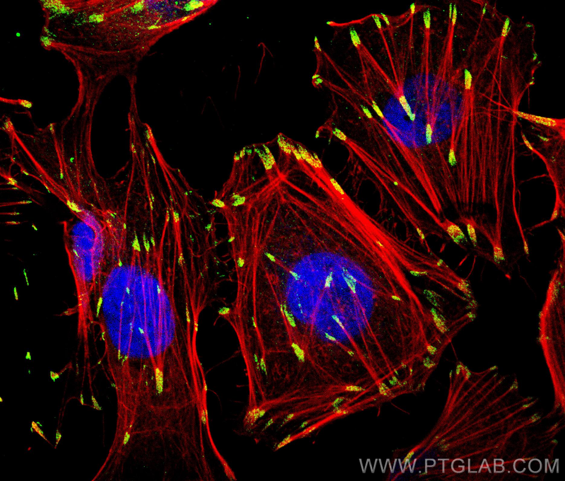 Immunofluorescence (IF) / fluorescent staining of HUVEC cells using Paxillin Polyclonal antibody (10029-1-Ig)