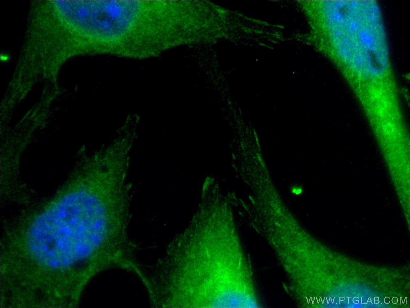 Immunofluorescence (IF) / fluorescent staining of NIH/3T3 cells using Paxillin Polyclonal antibody (10029-1-Ig)