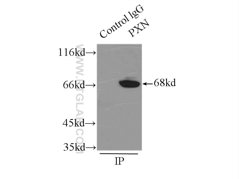 Immunoprecipitation (IP) experiment of mouse brain tissue using Paxillin Polyclonal antibody (10029-1-Ig)