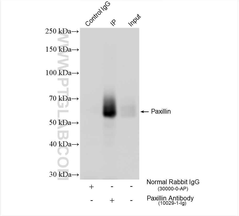 Immunoprecipitation (IP) experiment of A431 cells using Paxillin Polyclonal antibody (10029-1-Ig)