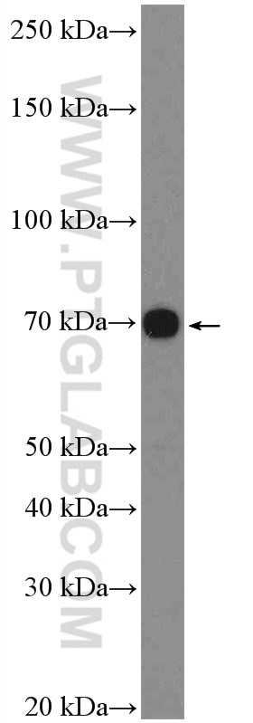 Western Blot (WB) analysis of COLO 320 cells using Paxillin Polyclonal antibody (10029-1-Ig)
