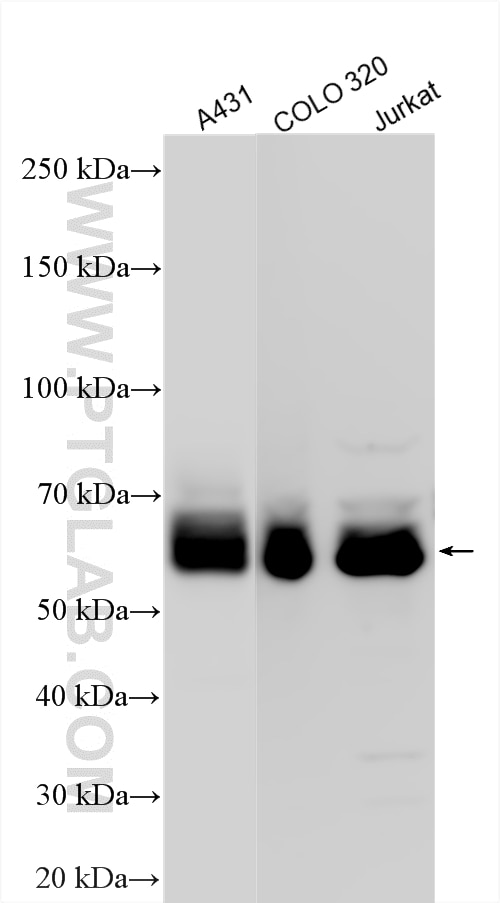 WB analysis using 10029-1-Ig Western Blot (WB) analysis of various lysates using Paxillin Polyclonal antibody (10029-1-Ig)
