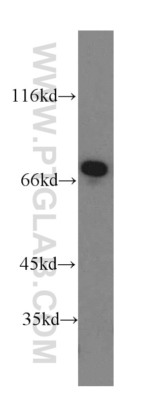 Western Blot (WB) analysis of mouse brain tissue using Paxillin Polyclonal antibody (10029-1-Ig)
