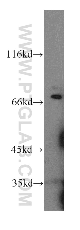 Western Blot (WB) analysis of Jurkat cells using Paxillin Polyclonal antibody (10029-1-Ig)