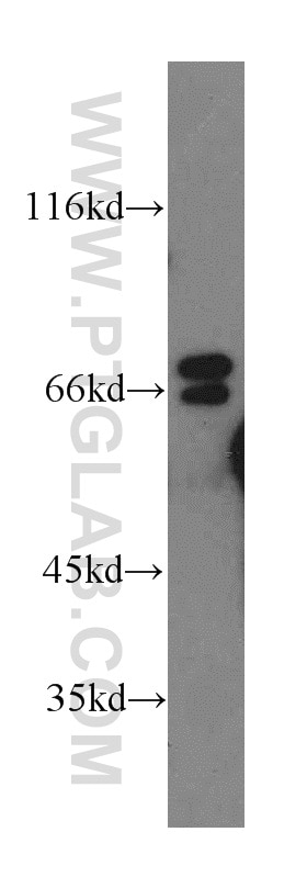 Western Blot (WB) analysis of MCF-7 cells using Paxillin Polyclonal antibody (10029-1-Ig)