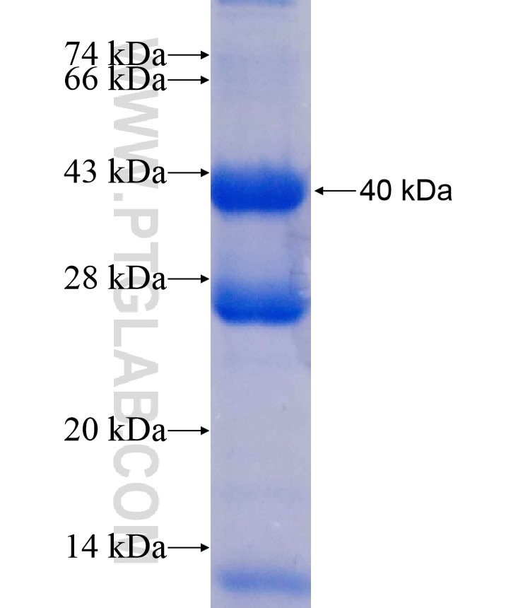 PXN fusion protein Ag17702 SDS-PAGE
