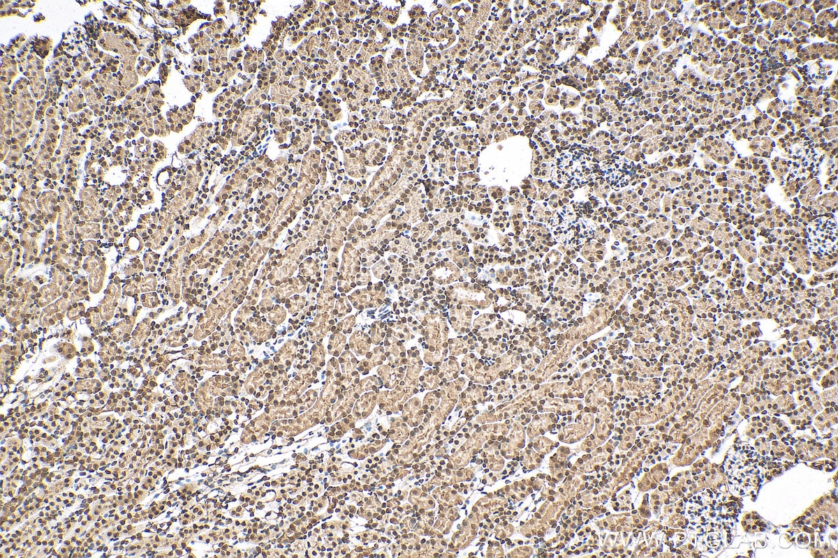 IHC staining of mouse kidney using 67912-1-Ig